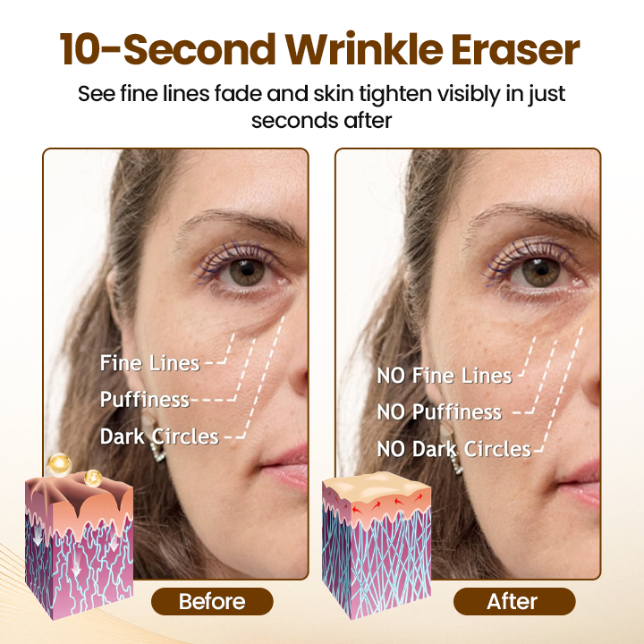 ✨LAST DAY SALE 60% OFF✨The Express "Instant Facelift" – Smooths Wrinkles in Seconds!