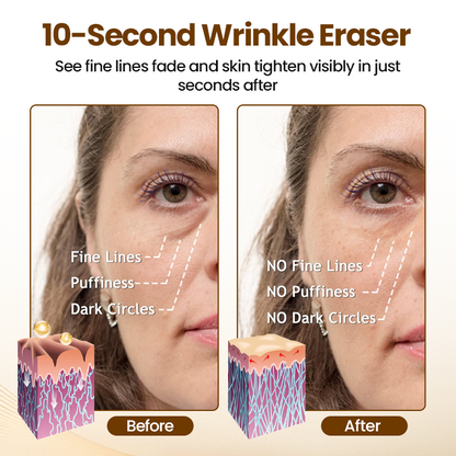 ✨LAST DAY SALE 60% OFF✨The Express "Instant Facelift" – Smooths Wrinkles in Seconds!