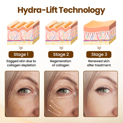 ✨LAST DAY SALE 60% OFF✨The Express "Instant Facelift" – Smooths Wrinkles in Seconds!